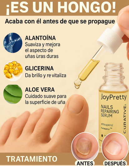 JoyPretty™ ¡Elimina los hongos de tus uñas de raíz!