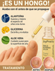 JoyPretty™ ¡Elimina los hongos de tus uñas de raíz!