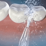 LIMPIADOR IRRIGADOR DENTAL PORTÁTIL - AquaSmile