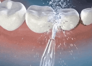 LIMPIADOR IRRIGADOR DENTAL PORTÁTIL - AquaSmile